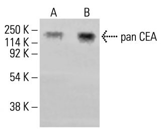 pan CEA Antibody (D14HD11) - Western Blotting - Image 413234 