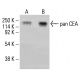 pan CEA Antibody (D14HD11) - Western Blotting - Image 413234 