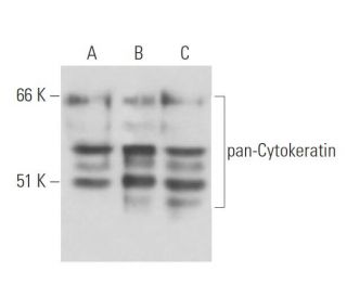 pan-Cytokeratin Antibody (80) - Western Blotting - Image 16195 