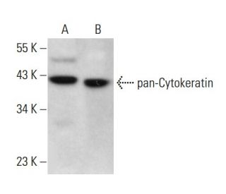pan-Cytokeratin Antibody (AE13) - Western Blotting - Image 376105 