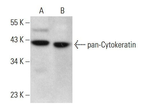 pan-cytokeratin-antibody-ae13-