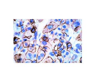 pan-Cytokeratin Antibody (C11) | SCBT - Santa Cruz Biotechnology