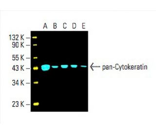 pan-cytokeratin-antibody-c11-