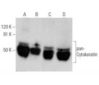 western blotting image from recommended pan-Cytokeratin (C11) monoclonal antibody replacement. Image 354292