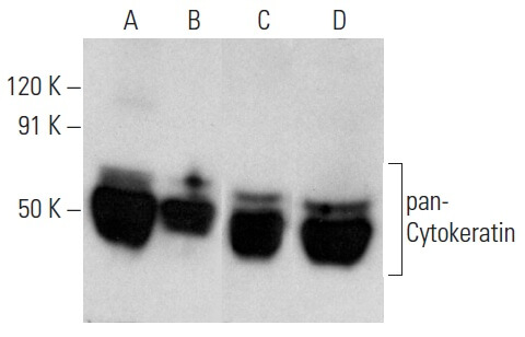 pan-cytokeratin-antibody-h-240