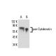 pan-Cytokeratin Antibody (HEP 111) - Western Blotting - Image 17230 