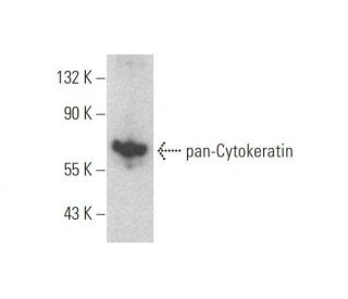pan-Cytokeratin Antibody (PK110) - Western Blotting - Image 352390 