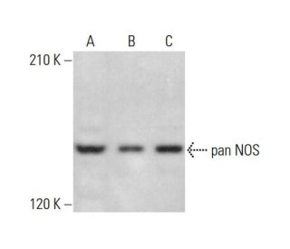 pan NOS Antibody (NOS-3F7-B11 B5) - Western Blotting - Image 348907 