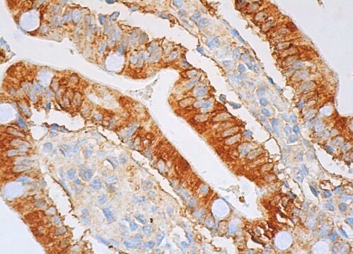 Anti-pan Ras Antibody (C-4) | SCBT - Santa Cruz Biotechnology