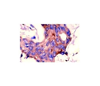pan Ras Antibody (F132) - Immunohistochemistry - Image 4208