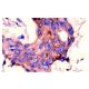 pan Ras Antibody (F132) - Immunohistochemistry - Image 4208