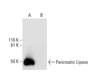 Pancreatic Lipase Antibody (A-2) - Western Blotting - Image 292045 