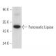 Pancreatic Lipase Antibody (A-2) - Western Blotting - Image 358049