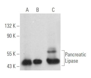 Pancreatic Lipase Antibody (G-11) - Western Blotting - Image 360490 