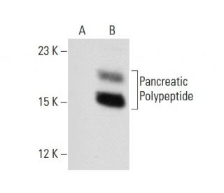 Pancreatic Polypeptide Antibody (030-06-1) - Western Blotting - Image 65366
