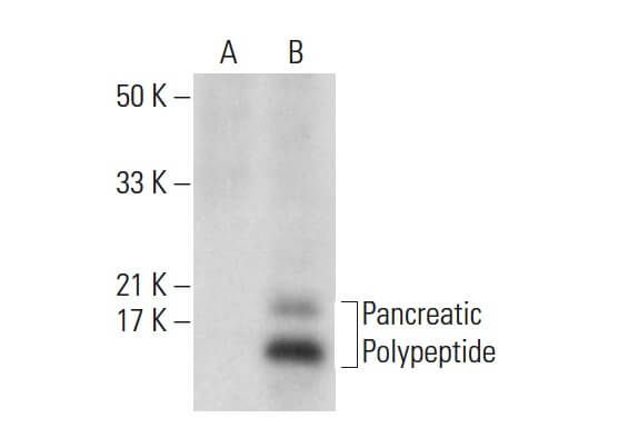 Pancreatic Polypeptide Antibody (B-2) | SCBT - Santa Cruz Biotechnology