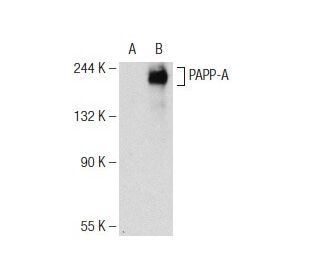 PAPP-A Antibody (B-7) - Western Blotting - Image 146799Each CRISPR/Cas9 Knockout (KO) Plasmid product consists of a pool of 3 plasmids designed to ensure identification and cleavage of a specific gene for maximum knockout efficiency. Each plasmid encodes a unique 20 nt sequence derived from the GeCKO (v2) library. 