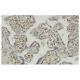 PAPSS 2 Antibody (SQ-19) - Immunohistochemistry - Image 36167 