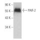 PAR-2 Antibody (3G233) - Western Blotting - Image 354611 
