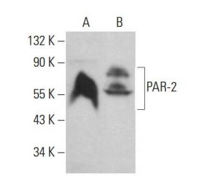 PAR-2 Antibody (3G233) - Western Blotting - Image 379959 