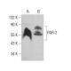 PAR-2 Antibody (3G233) - Western Blotting - Image 379959 