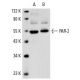 This polyclonal antibody has been discontinued. See our recommended <a href="par-2-antibody-sam11">PAR-2 (SAM11)</a> monoclonal antibody (sample data shown). western blotting image from recommended PAR-2 (SAM11) monoclonal antibody replacement. Image 2884