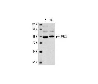 western blotting image from recommended PAR-2 (SAM11) monoclonal antibody replacement. Image 2884