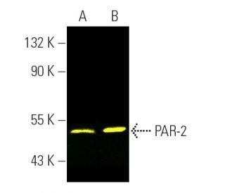 PAR-2 Antibody (SAM11) - Western Blotting - Image 391079