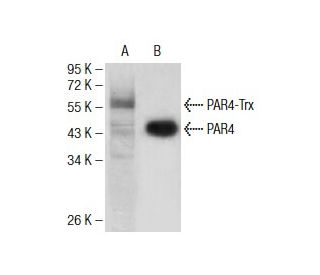 PAR4 Antibody (4H12E9) - Western Blotting - Image 137481 
