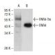 PAR4 Antibody (4H12E9) - Western Blotting - Image 137481 