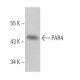 PAR4 Antibody (4H12E9) - Western Blotting - Image 372285