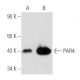 This polyclonal antibody has been discontinued. See our recommended <a href="par4-antibody-a-10">PAR4 (A-10)</a> monoclonal antibody (sample data shown). western blotting image from recommended PAR4 (A-10) monoclonal antibody replacement. Image 354829