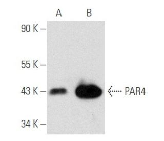 western blotting image from recommended PAR4 (A-10) monoclonal antibody replacement. Image 354829