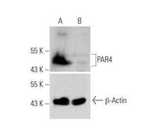 PAR4 HDR Plasmid (h): sc-401142-HDR. Western blot analysis of PAR4 expression in non-transfected control (A) and puromycinEach CRISPR/Cas9 Knockout (KO) Plasmid product consists of a pool of 3 plasmids designed to ensure identification and cleavage of a specific gene for maximum knockout efficiency. Each plasmid encodes a unique 20 nt sequence derived from the GeCKO (v2) library.
