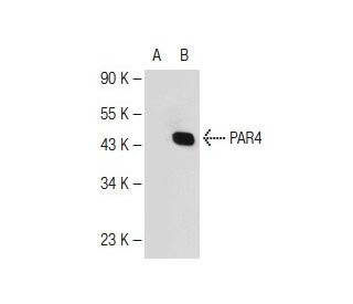 PAR4 Antibody (3G9H7) - Western Blotting - Image 109939Each CRISPR/Cas9 Knockout (KO) Plasmid product consists of a pool of 3 plasmids designed to ensure identification and cleavage of a specific gene for maximum knockout efficiency. Each plasmid encodes a unique 20 nt sequence derived from the GeCKO (v2) library. 