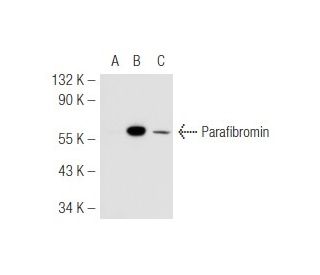 Parafibromin Antibody (2H1) - Western Blotting - Image 48171 