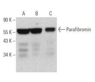Parafibromin Antibody (A-8) - Western Blotting - Image 361774 
