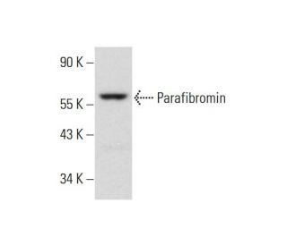 Parafibromin Antibody (G-11) - Western Blotting - Image 325220 