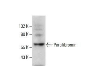 Parafibromin Antibody (G-9) - Western Blotting - Image 325218 