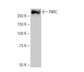 PARC Antibody (NQ-C32) - Western Blotting - Image 65026 