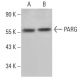 PARG Antibody (H-1) - Western Blotting - Image 376183 