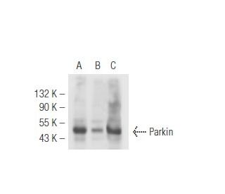 Parkin Antibody (D-1) - Western Blotting - Image 49286 