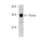 Parkin Antibody (D-1) - Western Blotting - Image 360537