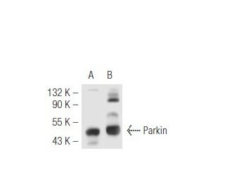 western blotting image from recommended Parkin (PRK8) monoclonal antibody replacement. Image 49285