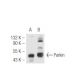 This polyclonal antibody has been discontinued. See our recommended <a href="parkin-antibody-prk8">Parkin (PRK8)</a> monoclonal antibody (sample data shown). western blotting image from recommended Parkin (PRK8) monoclonal antibody replacement. Image 49285