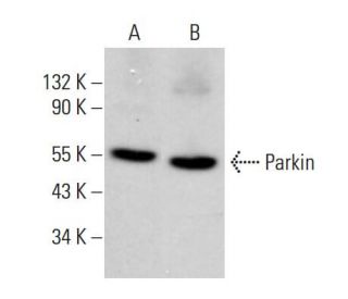 Parkin Antibody (H-8) - Western Blotting - Image 380648 