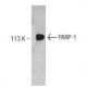 PARP1 Antibody (42) - Western Blotting - Image 127524
