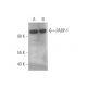 PARP1 Antibody (D-1) - Western Blotting - Image 349955 