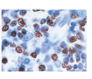 PARP-1 Antibody (F-2) - Immunohistochemistry - Image 160149