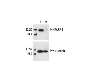 PARP-1 siRNA (h): sc-29437. Western blot analysis of PARP-1 expression in non-transfected control (A) and PARP-1 siRNA tra 